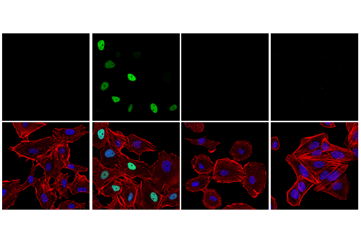 Immunofluorescence Image 1: Phospho-p53 (Ser15) (E9Y4U) Rabbit mAb