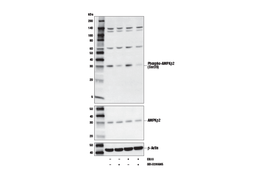 Western Blotting Image 1: Phospho-AMPKβ2 (Ser39) Antibody