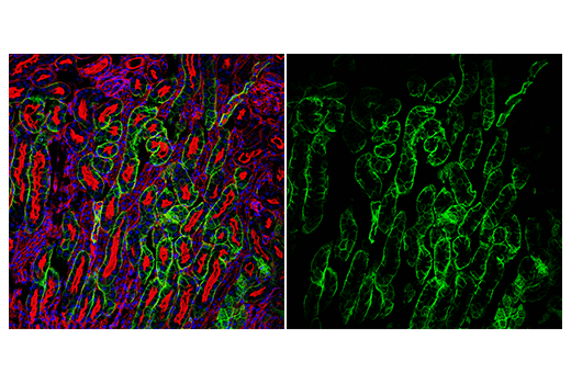 Immunofluorescence Image 3: AQP4 (D1F8E) XP® Rabbit mAb (Alexa Fluor® 488 Conjugate)
