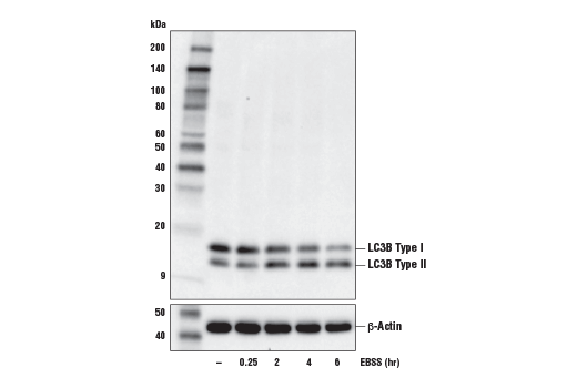  Image 29: Mouse Reactive Cell Death and Autophagy Antibody Sampler Kit