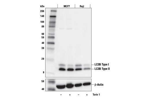  Image 33: Mouse Reactive Cell Death and Autophagy Antibody Sampler Kit