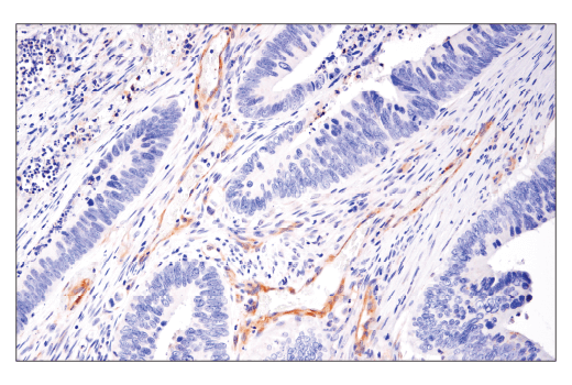  Image 41: Mouse Reactive Cell Death and Autophagy Antibody Sampler Kit