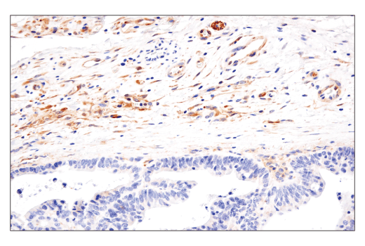  Image 42: Mouse Reactive Cell Death and Autophagy Antibody Sampler Kit