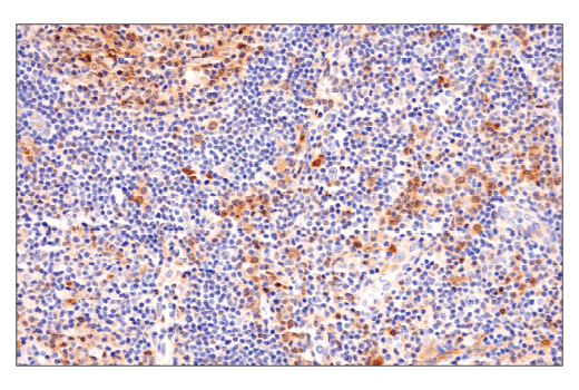 Image 48: Mouse Reactive Cell Death and Autophagy Antibody Sampler Kit