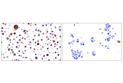  Image 59: Mouse Reactive Cell Death and Autophagy Antibody Sampler Kit