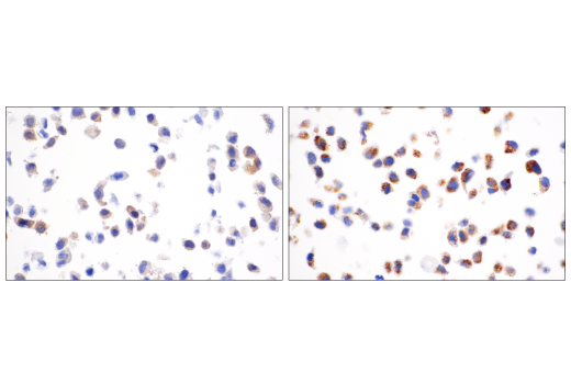  Image 60: Mouse Reactive Cell Death and Autophagy Antibody Sampler Kit