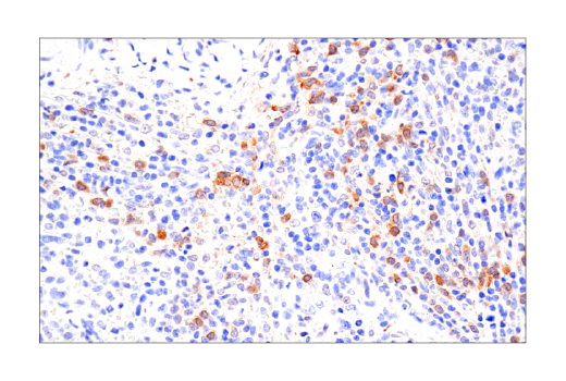  Image 61: Mouse Reactive Cell Death and Autophagy Antibody Sampler Kit