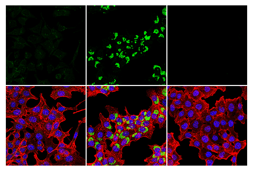  Image 62: Mouse Reactive Cell Death and Autophagy Antibody Sampler Kit