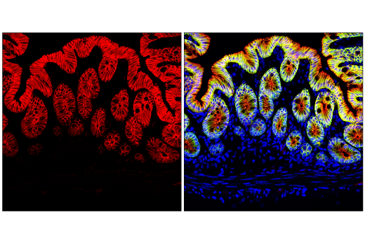 Immunofluorescence Image 1: β-Catenin (D10A8) XP® Rabbit mAb (Alexa Fluor® 555 Conjugate)
