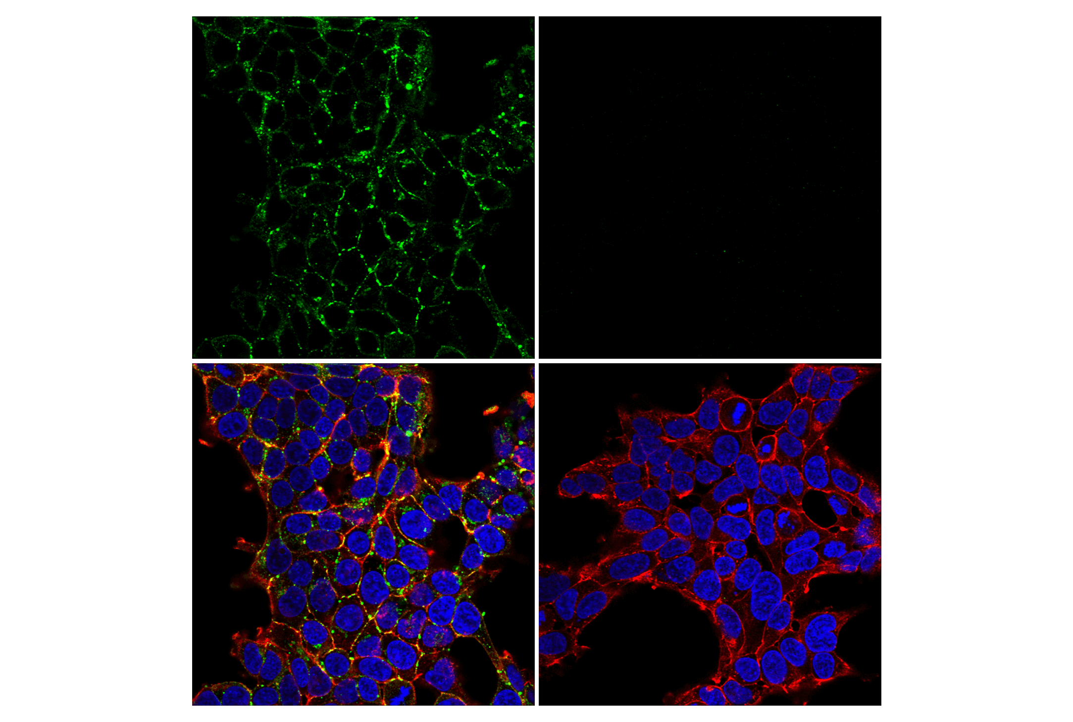 Immunofluorescence Image 2: Connexin 43 (E7N2R) XP® Rabbit mAb