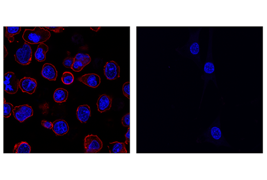 Immunofluorescence Image 2: PD-1 (Intracellular Domain) (D7D5W) XP® Rabbit mAb (Alexa Fluor® 594 Conjugate)