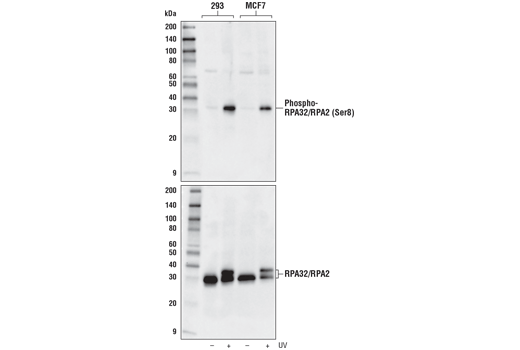 Western Blotting Image 1: Phospho-RPA32/RPA2 (Ser8) Antibody