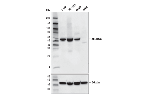Western Blotting Image 1: ALDH1A2 Antibody