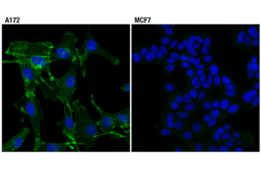 Immunofluorescence Image 1: N-Cadherin (D4R1H) XP® Rabbit mAb (BSA and Azide Free)
