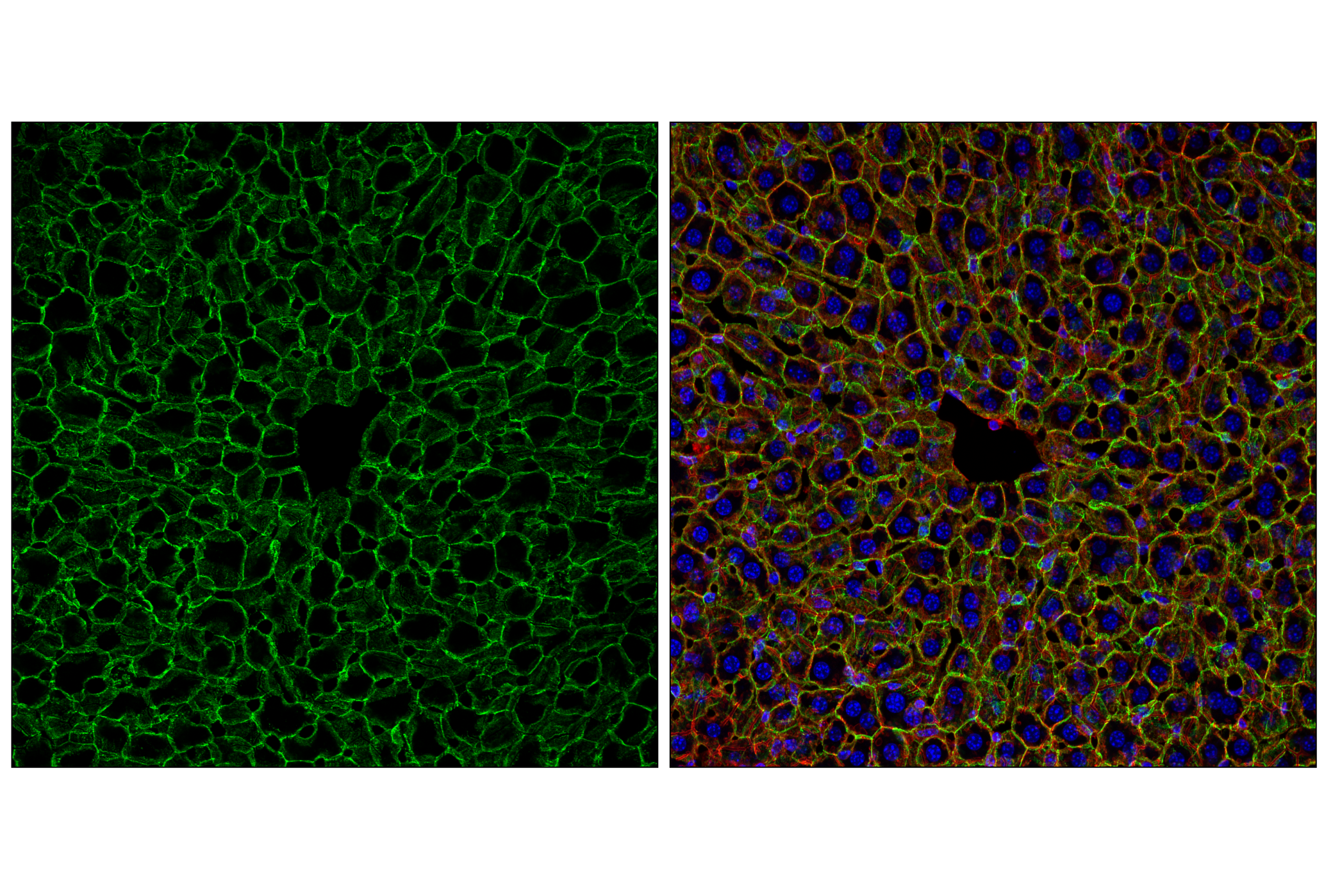 Immunofluorescence Image 1: N-Cadherin (D4R1H) XP<sup>®</sup> Rabbit mAb (BSA and Azide Free)