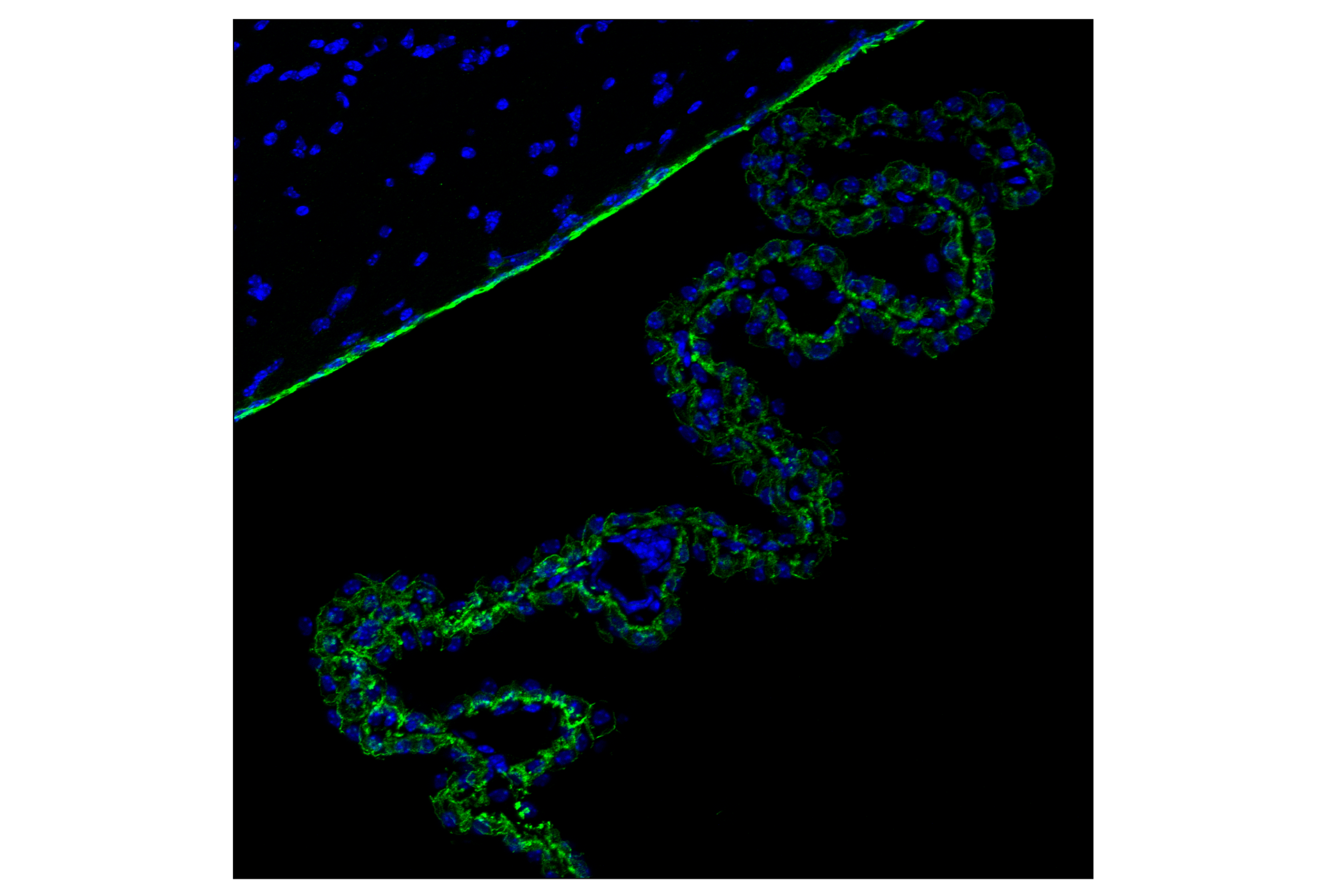 Immunofluorescence Image 2: N-Cadherin (D4R1H) XP<sup>®</sup> Rabbit mAb (BSA and Azide Free)