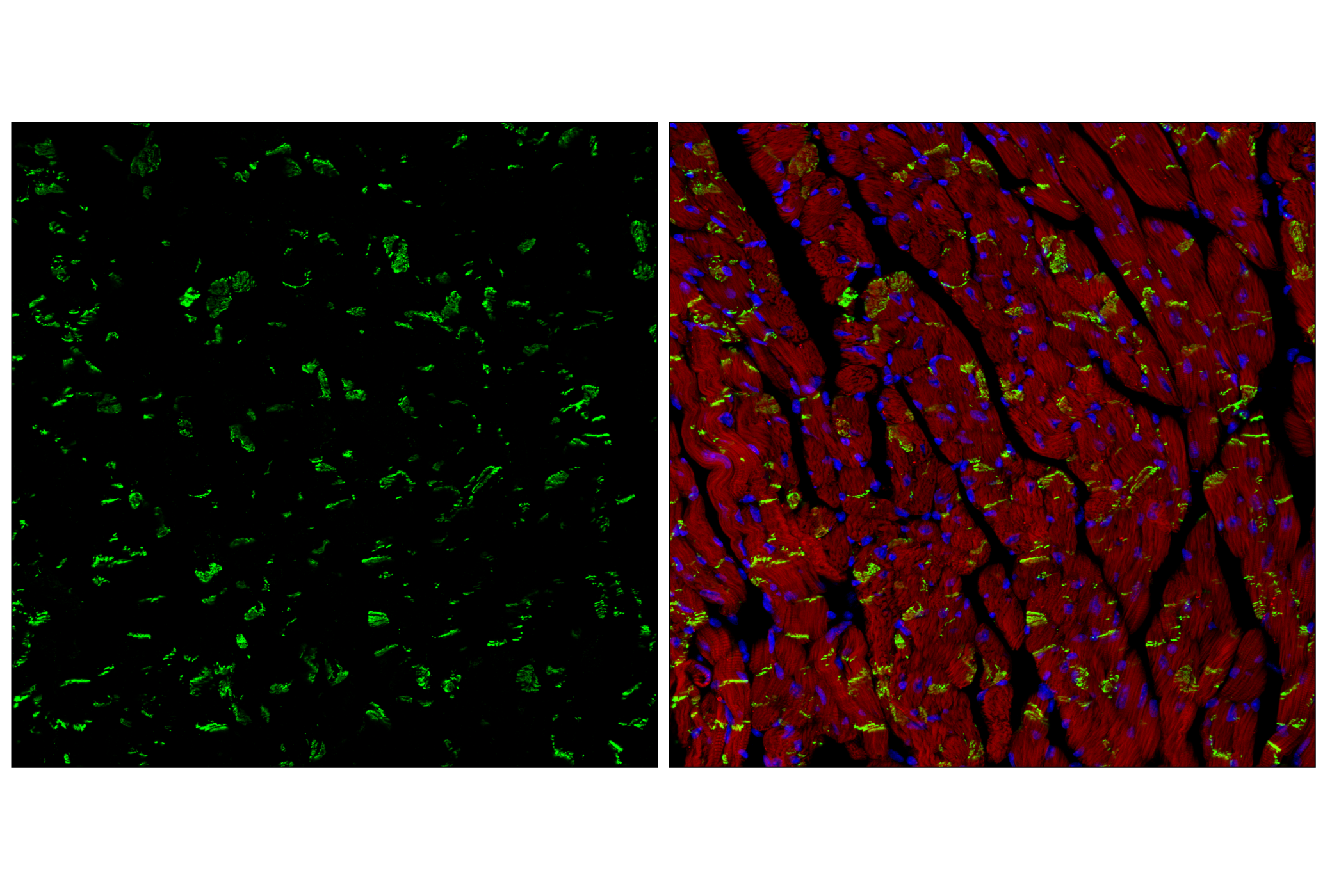 Immunofluorescence Image 3: N-Cadherin (D4R1H) XP<sup>®</sup> Rabbit mAb (BSA and Azide Free)