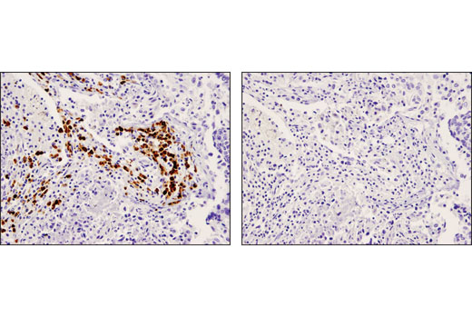 Immunohistochemistry Image 2: CD79A (D1X5C) XP® Rabbit mAb (BSA and Azide Free)