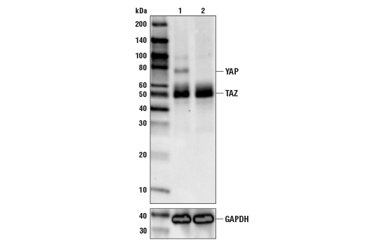  Image 21: Phospho-YAP/TAZ Antibody Sampler Kit
