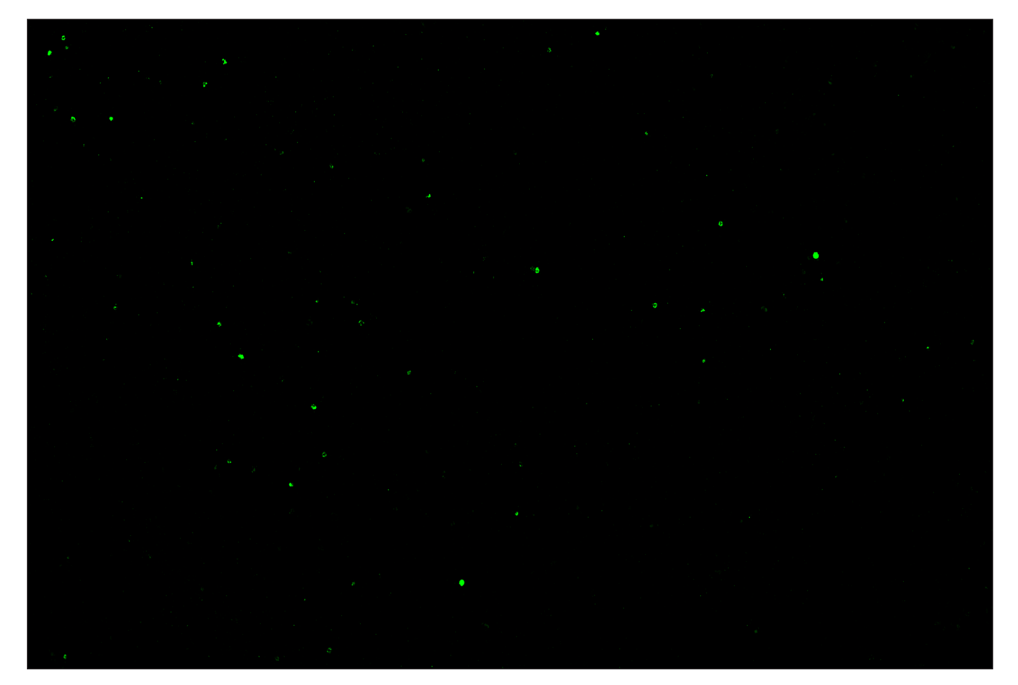 Immunohistochemistry Image 2: Granzyme B (E5V2L) & CO-0049-488 SignalStar™ Oligo-Antibody Pair