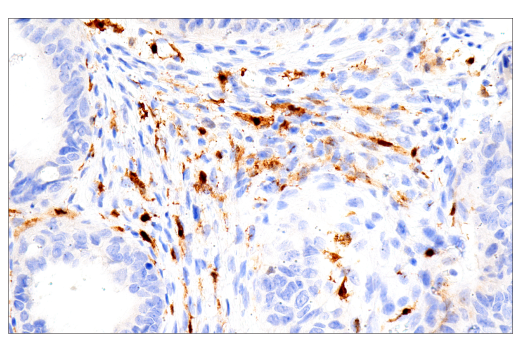 Immunohistochemistry Image 3: Factor XIIIA (E980.1) Mouse mAb
