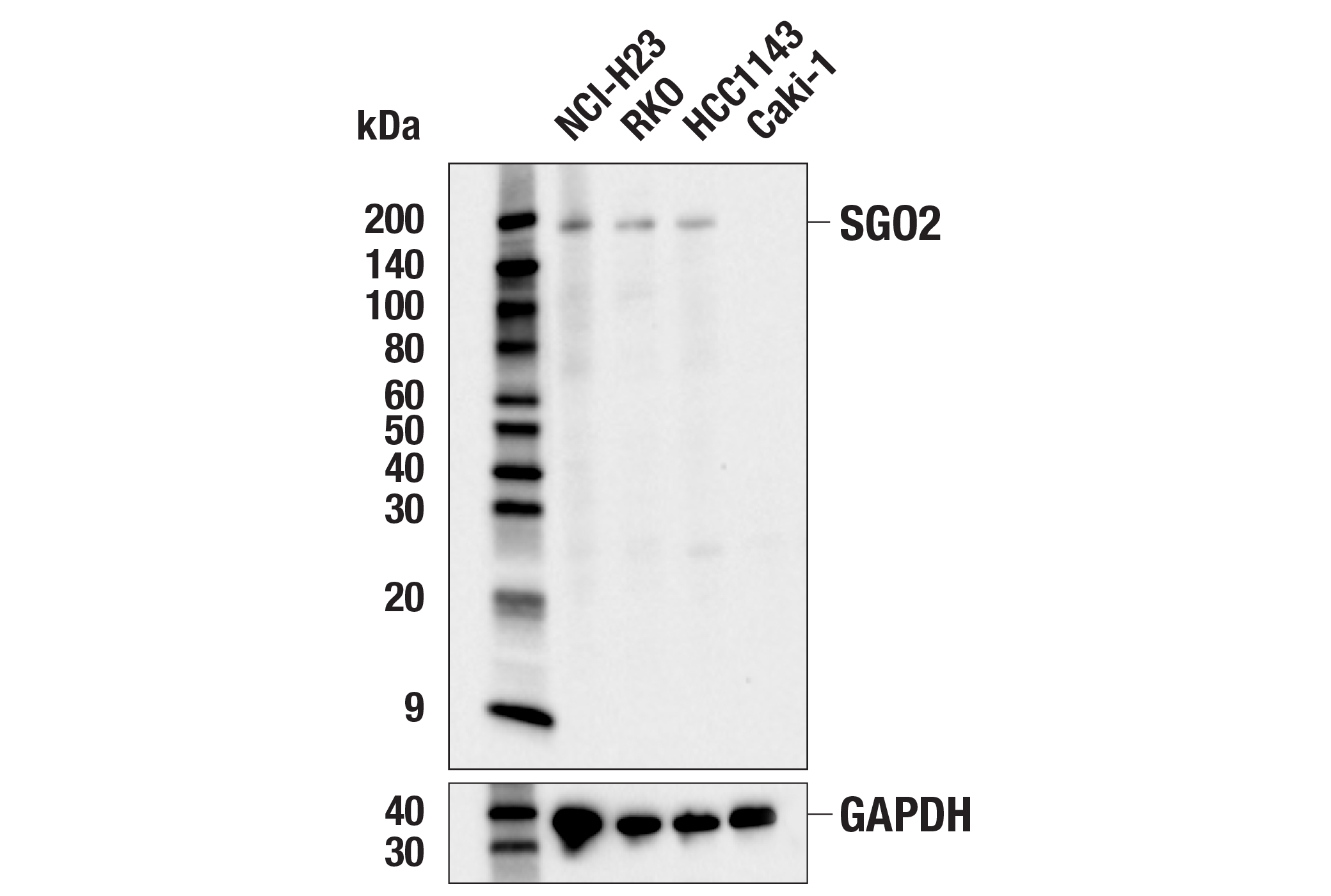 Western Blotting Image 1: SGO2 (E9K4N) Rabbit mAb (BSA and Azide Free)