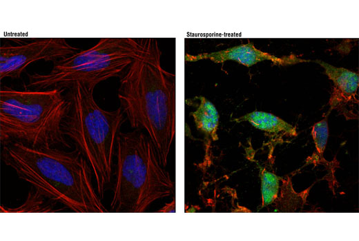 Immunofluorescence Image 1: Cleaved Caspase-7 (Asp198) (D6H1) Rabbit mAb
