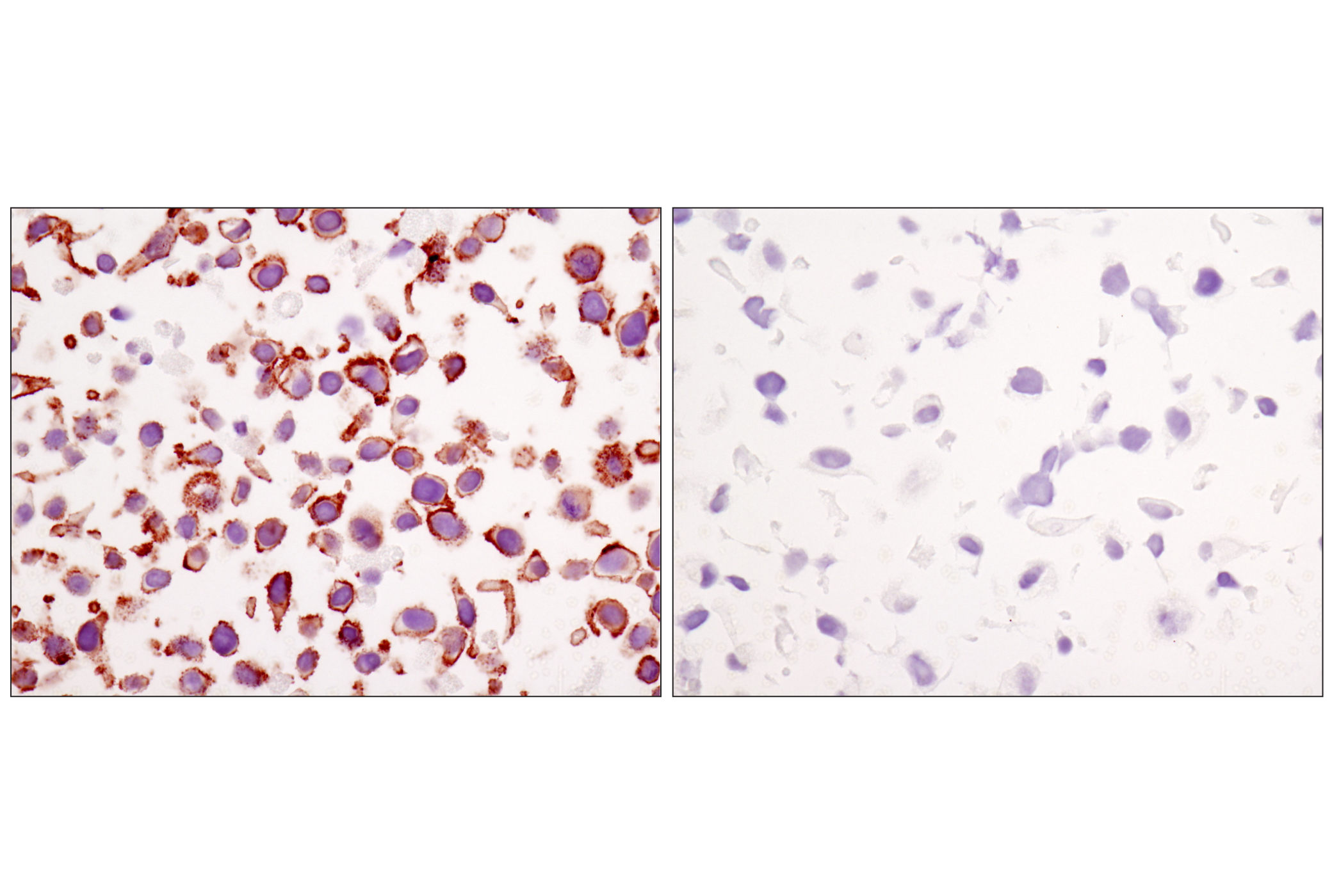 Immunohistochemistry Image 8: β-Catenin (D10A8) XP® Rabbit mAb (BSA and Azide Free)
