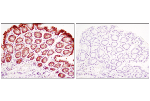 Immunohistochemistry Image 9: β-Catenin (D10A8) XP® Rabbit mAb (BSA and Azide Free)