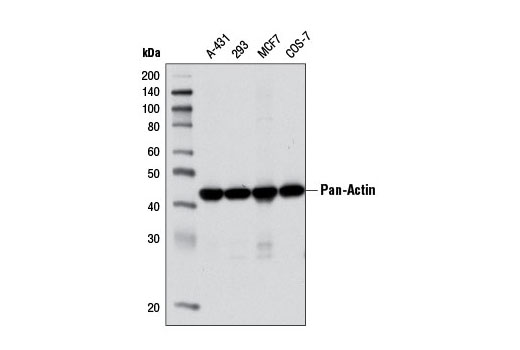 Western Blotting Image 1: Pan-Actin (D18C11) Rabbit mAb