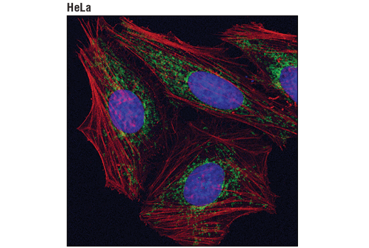  Image 32: Mitochondrial Dynamics Antibody Sampler Kit