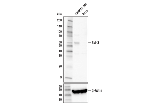 Western Blotting Image 1: Bcl-3 Antibody