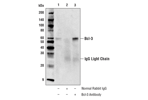 Immunoprecipitation Image 1: Bcl-3 Antibody