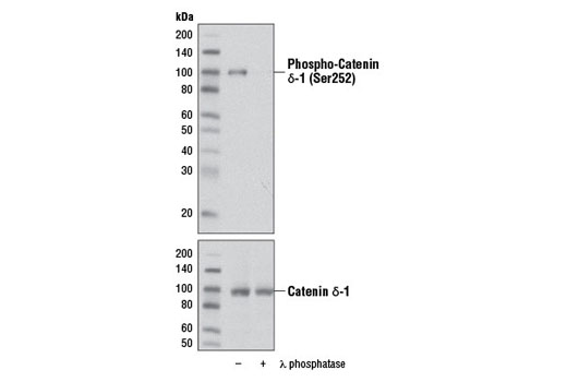 Western Blotting Image 1: Phospho-Catenin δ-1 (Ser252) Antibody