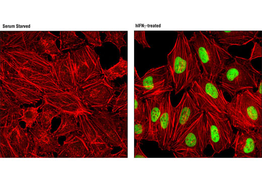 Immunofluorescence Image 1: IRF-1 (D5E4) XP® Rabbit mAb