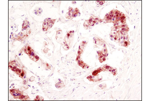  Image 18: PhosphoPlus® β-Catenin (Ser675) Antibody Duet