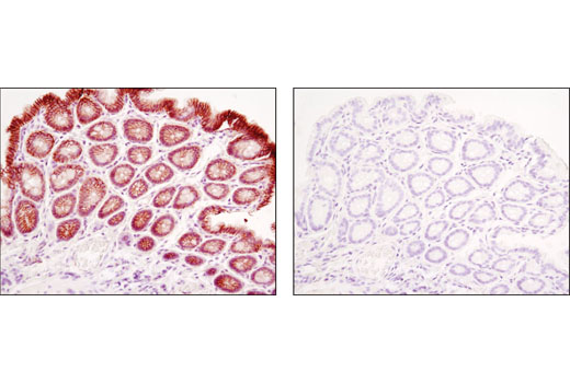  Image 20: PhosphoPlus® β-Catenin (Ser675) Antibody Duet
