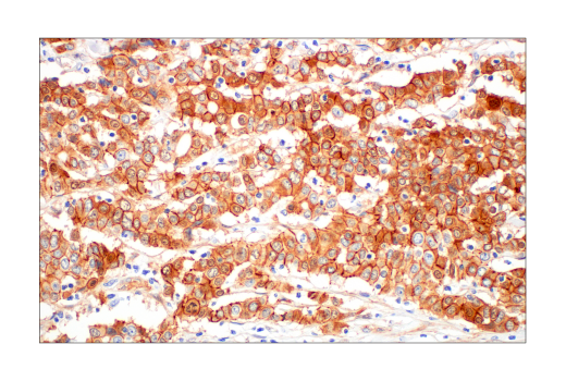 Immunohistochemistry Image 5: β-Catenin (D10A8) XP® Rabbit mAb