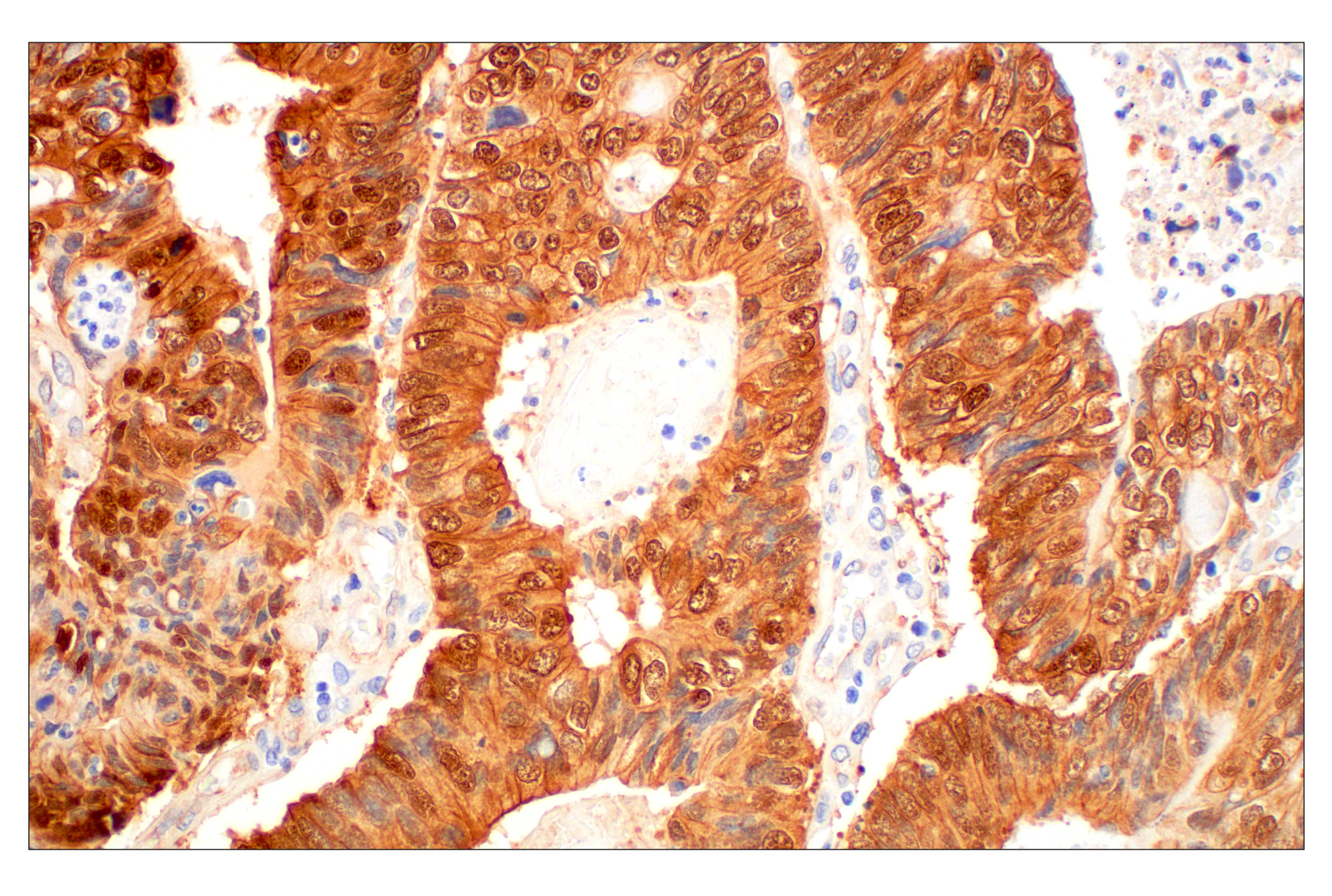  Image 17: PhosphoPlus® β-Catenin (Ser675) Antibody Duet