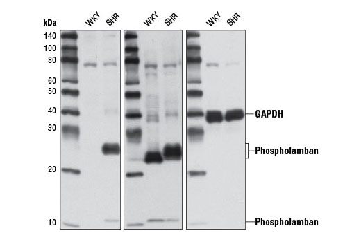 Western Blotting Image 1: Phospho-Phospholamban (Ser16/Thr17) Antibody