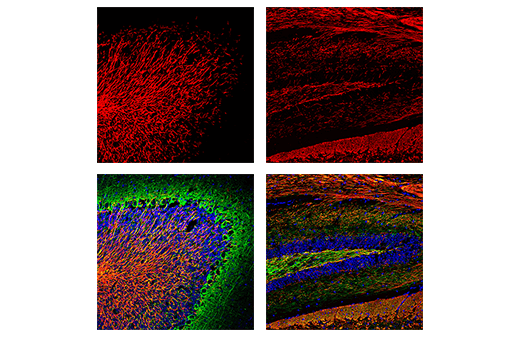 Immunofluorescence Image 1: Myelin Basic Protein (D8X4Q) XP® Rabbit mAb (Alexa Fluor® 555 Conjugate)