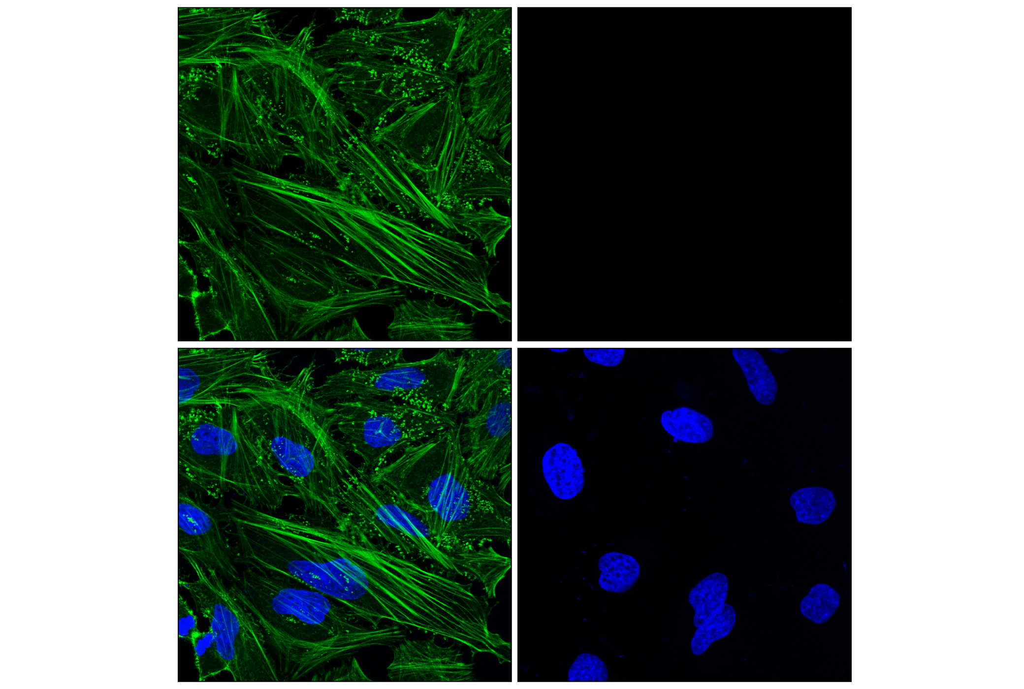 Immunofluorescence Image 1: β-Actin (D6A8) Rabbit mAb (Alexa Fluor® 488 Conjugate)