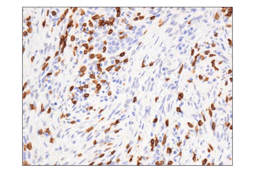 Immunohistochemistry Image 1: CD3ε (D7A6E™) XP® Rabbit mAb