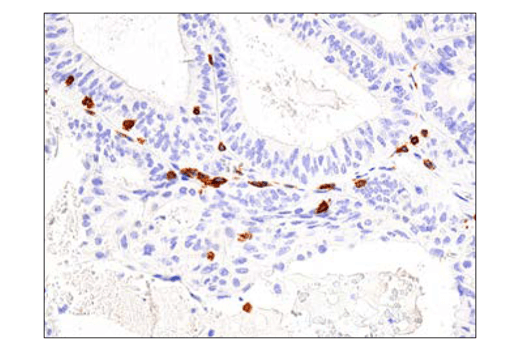  Image 28: Human Exhausted CD8+ T Cell IHC Antibody Sampler Kit