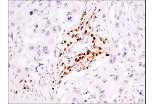  Image 46: Human Exhausted CD8+ T Cell IHC Antibody Sampler Kit