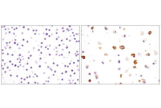 Immunohistochemistry Image 6: PD-L1 (D5V3B) Rabbit mAb (Mouse Specific; IHC Specific) (BSA and Azide Free)