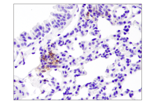 Immunohistochemistry Image 3: PD-L1 (D5V3B) Rabbit mAb (Mouse Specific; IHC Specific) (BSA and Azide Free)