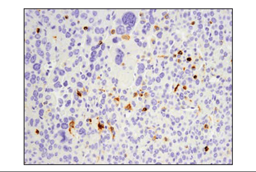 Immunohistochemistry Image 1: PD-L1 (D5V3B) Rabbit mAb (Mouse Specific; IHC Specific) (BSA and Azide Free)