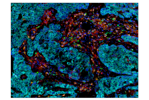 Immunohistochemistry Image 5: PD-L1 (E1L3N®) XP® Rabbit mAb (BSA and Azide Free)