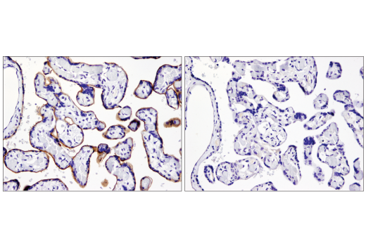 Immunohistochemistry Image 3: PD-L1 (E1L3N®) XP® Rabbit mAb (BSA and Azide Free)